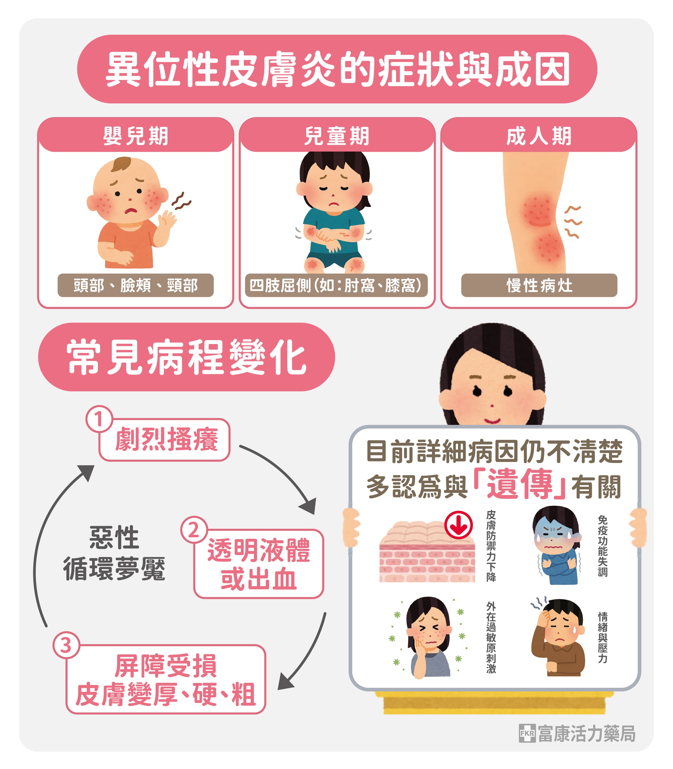 異位性皮膚炎症狀,異位性皮膚炎成因,異位性皮膚炎跟遺傳有關嗎,異位性皮膚炎會出現在甚麼部位