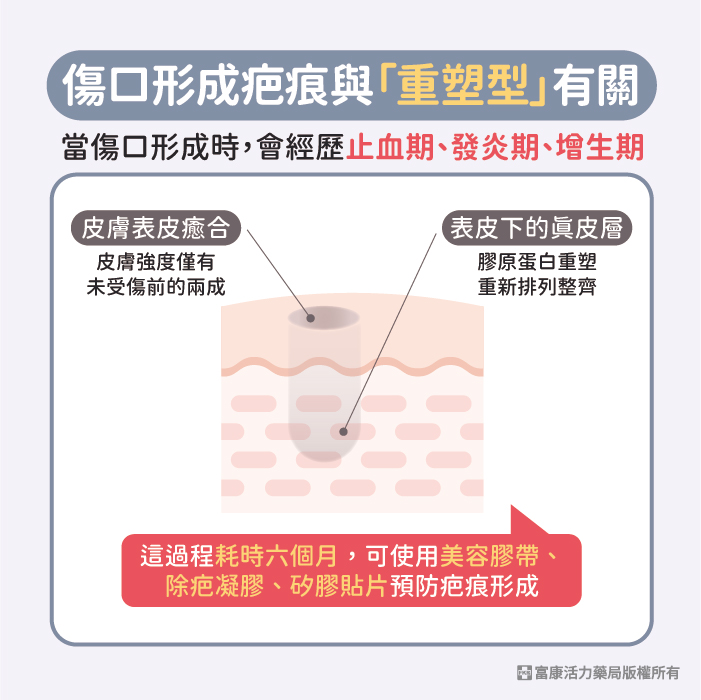 3M 免縫膠帶 ( 美容膠帶 ) 傷口護理專用｜剖腹產適用｜多尺寸選擇