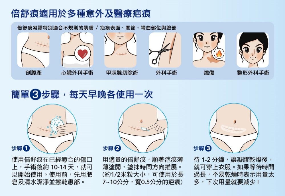 Dermatix Ultra 倍舒痕凝膠 15g/條,倍舒,除疤凝膠,系凝膠,矽膠,但疤凝膠