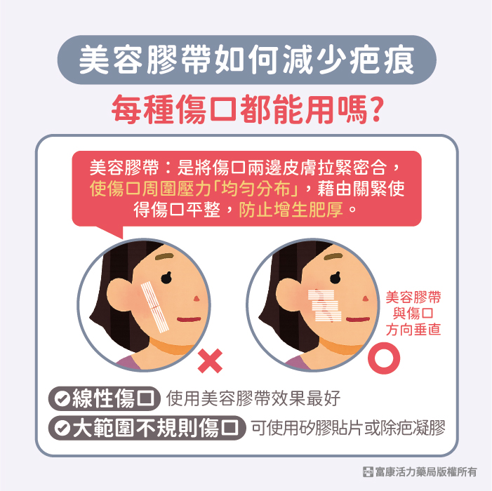 3M 免縫膠帶 ( 美容膠帶 ) 傷口護理專用｜剖腹產適用｜多尺寸選擇