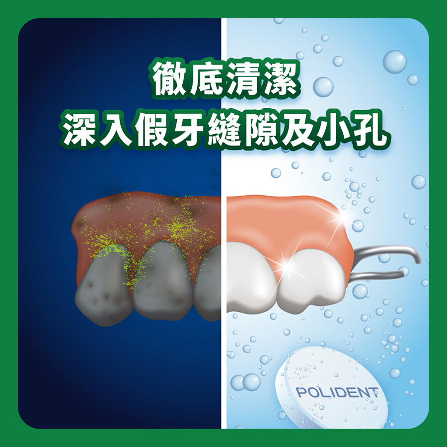 【贈假牙牙刷+漱口杯】保麗淨 局部假牙清潔錠 72片_新包裝