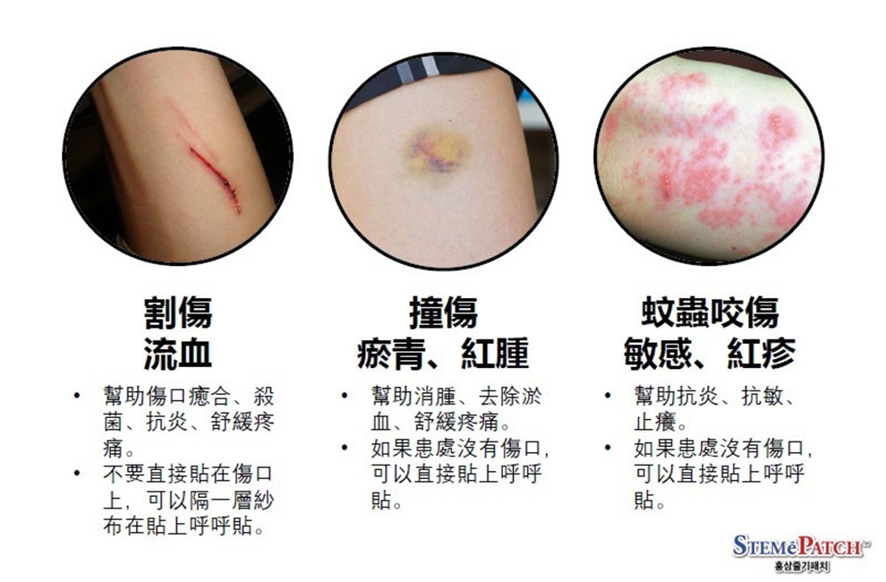 呼呼清涼貼