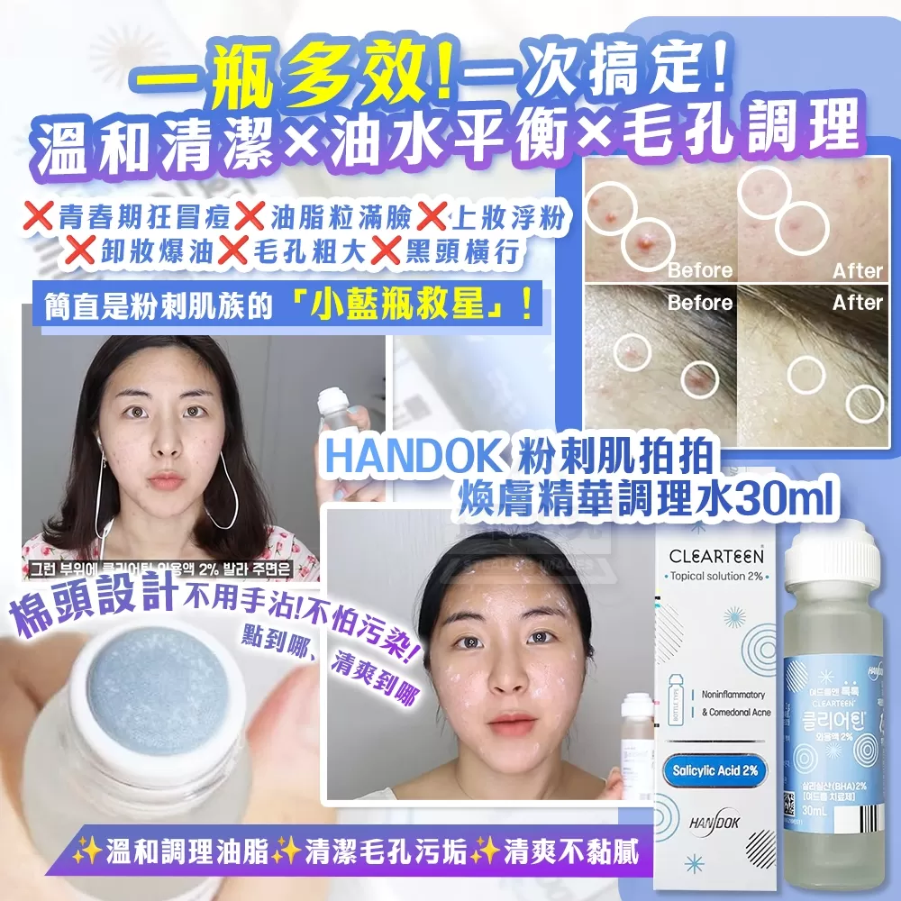 韓國製造 HANDOK 粉刺肌拍拍煥膚精華調理水30ml