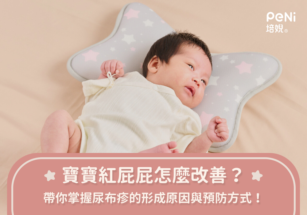 寶寶紅屁屁怎麼改善？帶你掌握尿布疹的形成原因與預防方式！