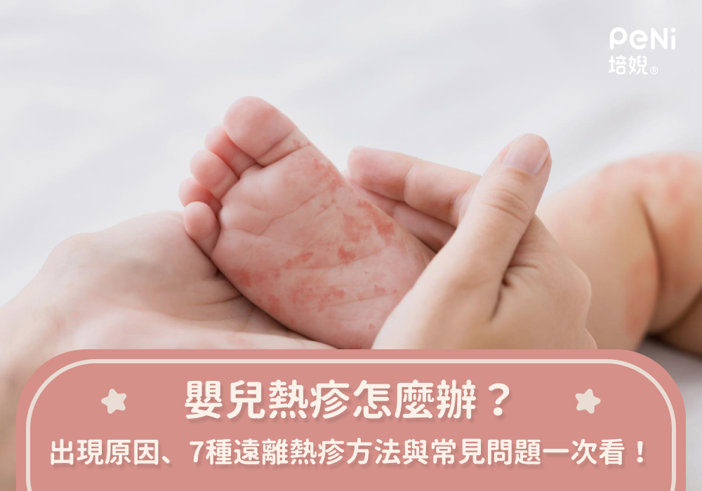 嬰兒熱疹怎麼辦？出現原因、7種遠離熱疹方法與常見問題一次看！