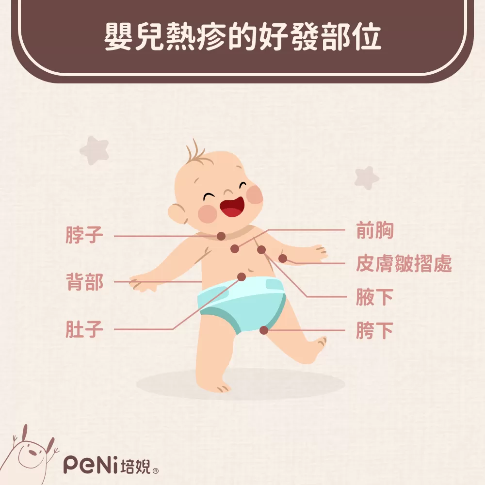 嬰兒熱枕的好發部位