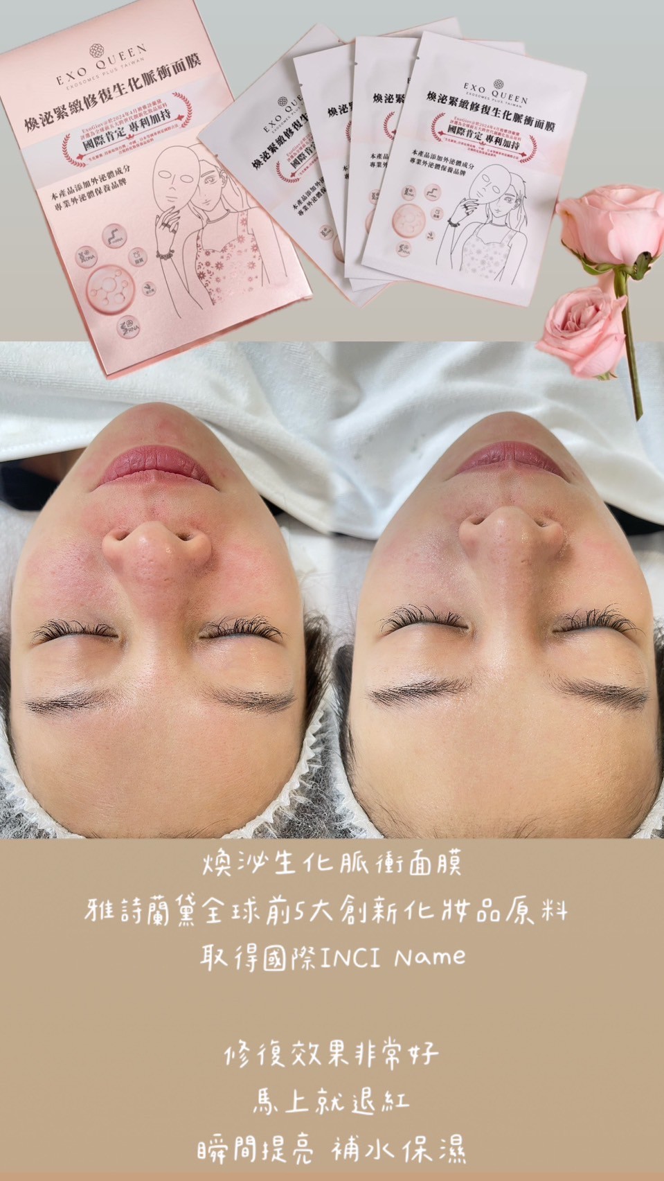 面膜預購活動 買2盒送2片