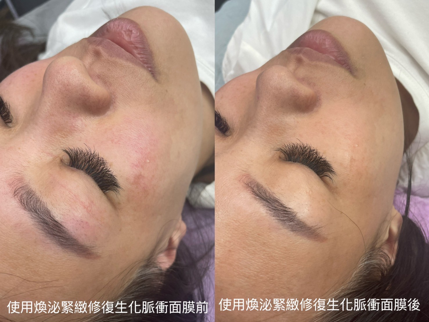 面膜預購活動 買2盒送2片