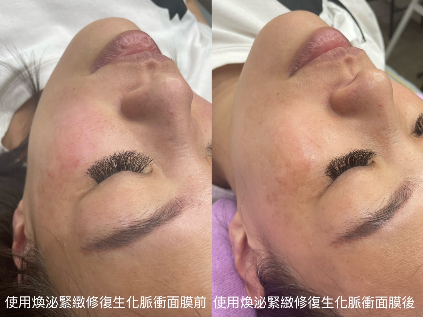 面膜預購活動 買2盒送2片