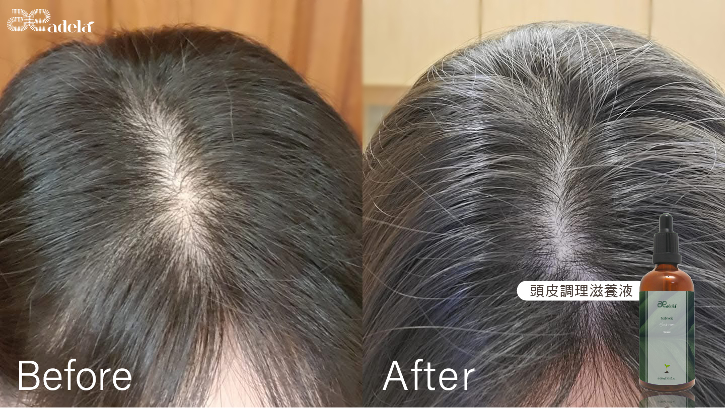 頭皮調理滋養液,頭皮屑,滋養,修護,強健、滋養,U51460007