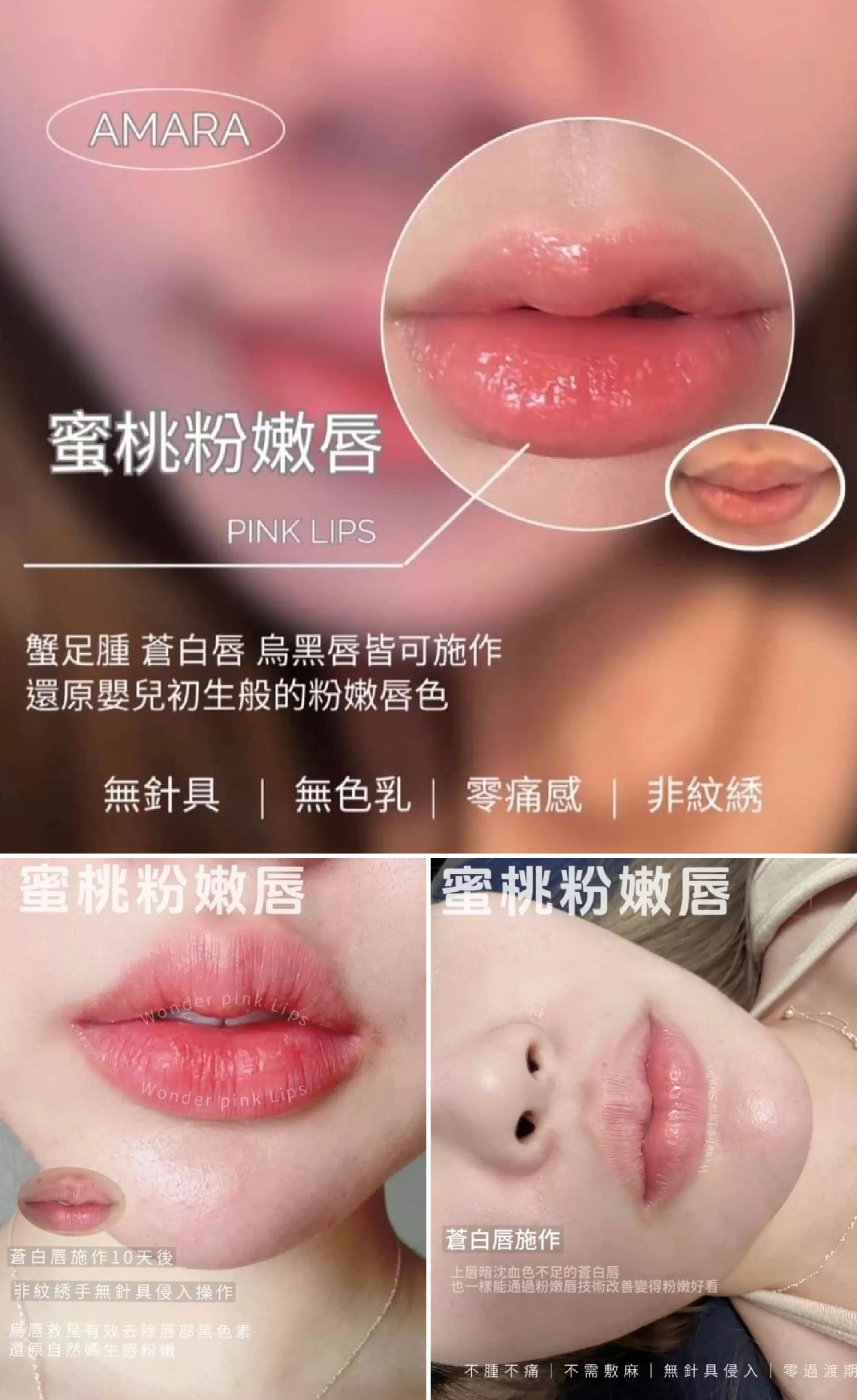 AMARA PINK無創蜜桃粉嫩唇課程