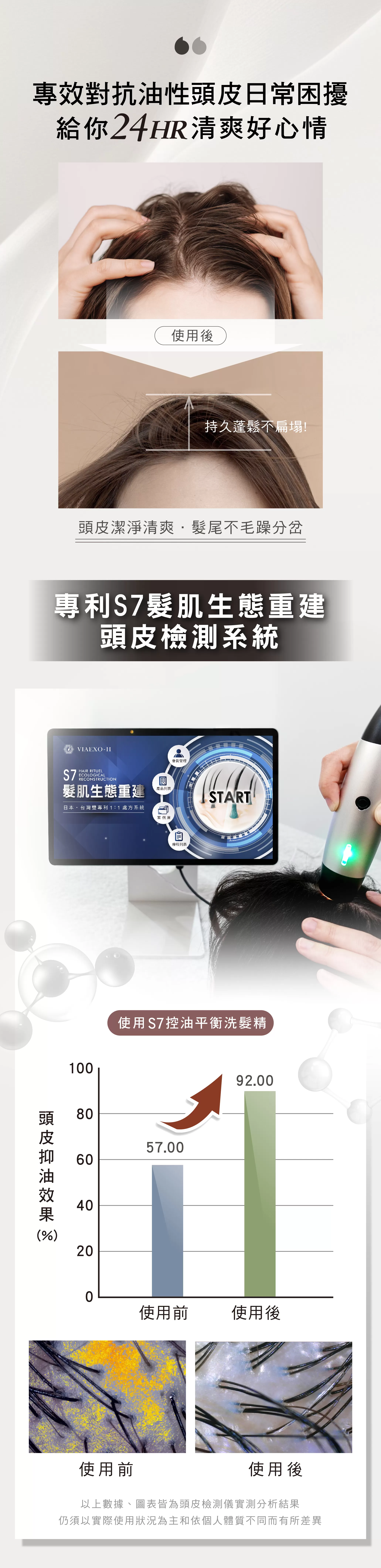 S7控油平衡洗髮精