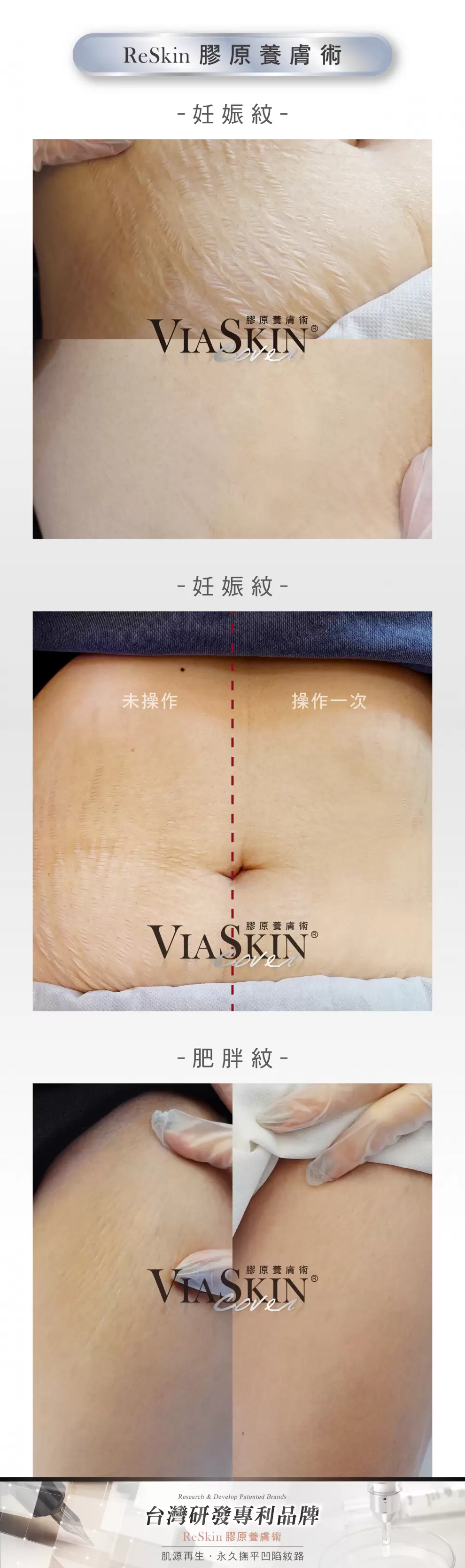 VIASKIN膚色重建課程