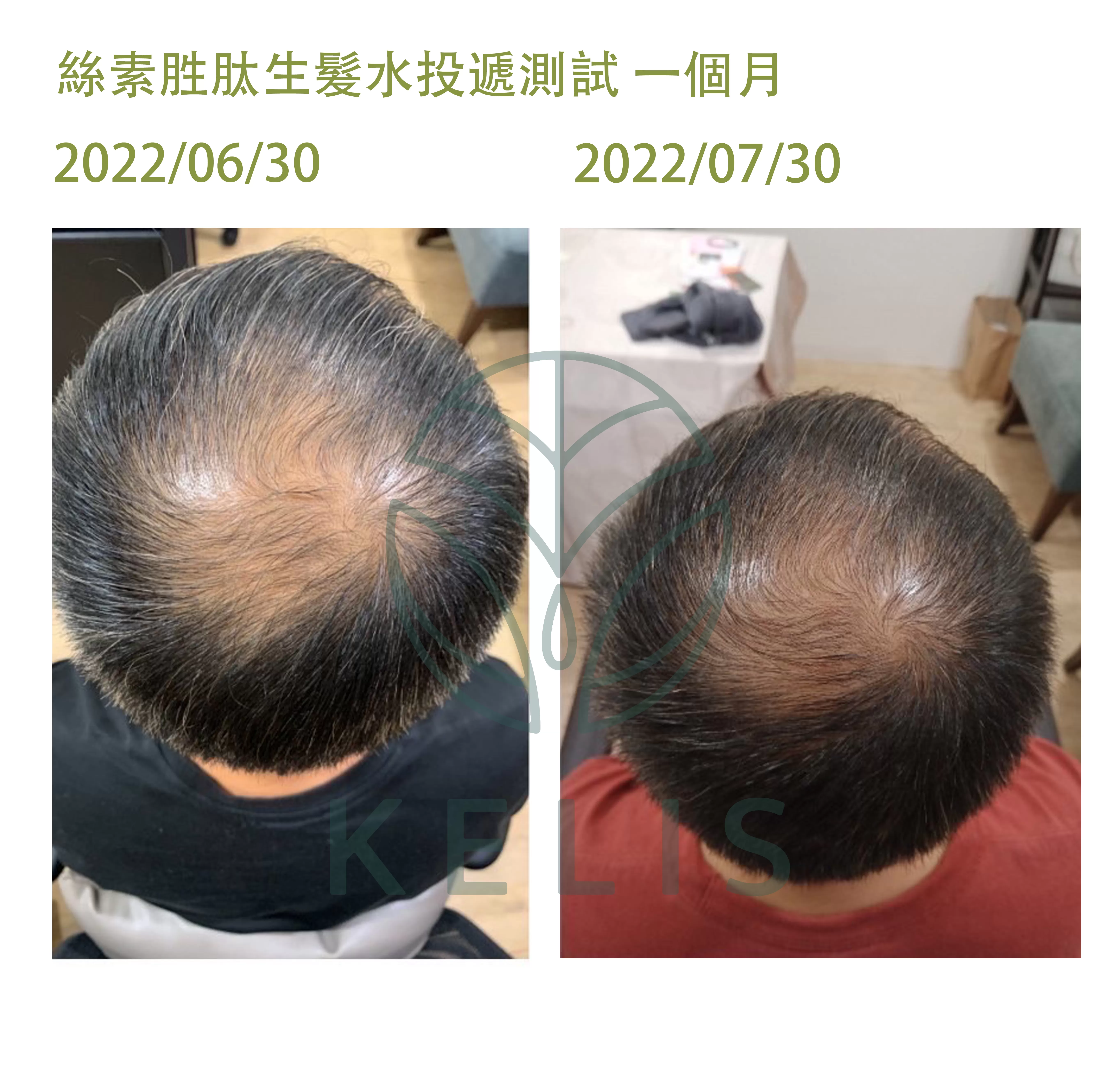 絲素胜肽養髮液(單入),會員95折,U53160002,絲素胜肽養髮液(單入),強健髮根,刺激生髮