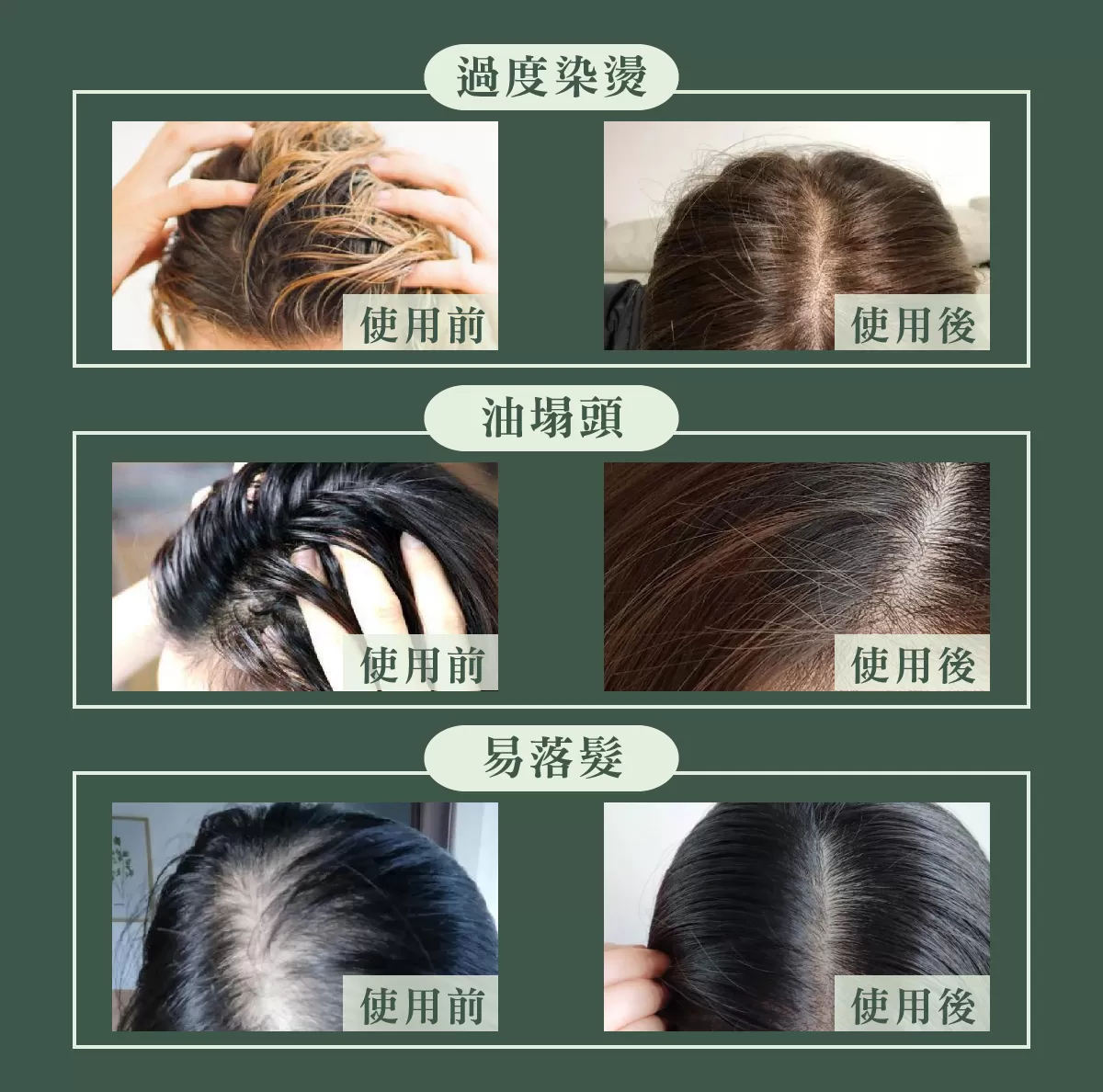 【MG瑪格諾莉雅】北極重生水頭皮精華液(80ml)