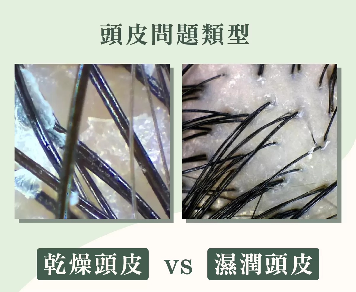 【MG瑪格諾莉雅】北極重生水頭皮精華液(80ml)