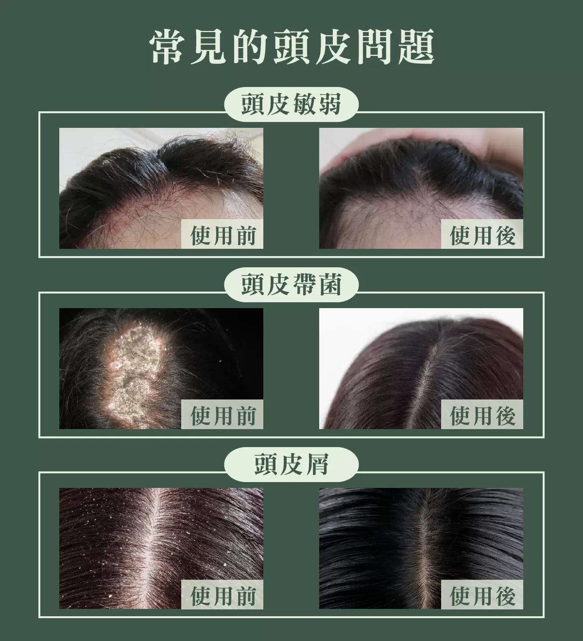 【MG瑪格諾莉雅】北極重生水頭皮精華液(80ml)