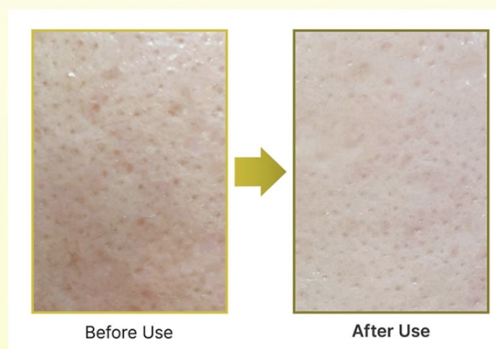 Arencia 維他命C亮白精華乳霜 30ml,U60740006,Arencia維他命C亮白精華乳霜30ml,提升彈力,淡化細紋,所有商品