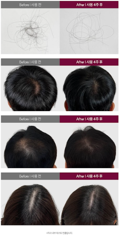 韓國 Dr.MonFri 魔法學啤酒酵母抓抓髮絲在洗髮精 1059ml