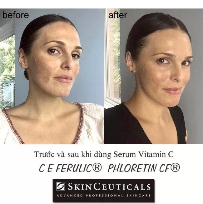 SkinCeuticals修麗可 超濃度CE緊緻修護抗氧化精華15ml