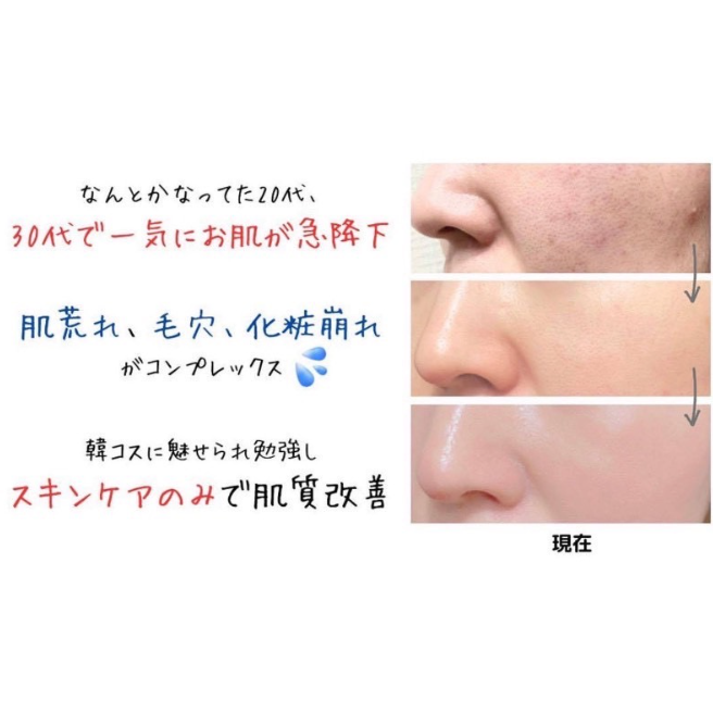 韓國VT 微晶針精華大禮包 2ml*45ea