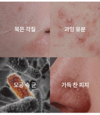 ilso No Problem 溫和煥膚棉棒 8支/盒,U60690009,ilsoNoProblem溫和煥膚棉棒8支/盒,細緻發光,溫和煥膚,所有商品